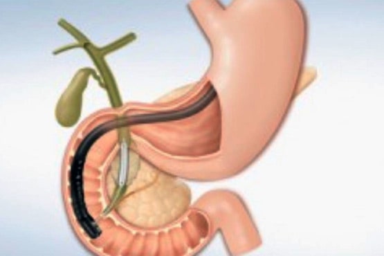 C P R E en Guayaquil | GastroEC