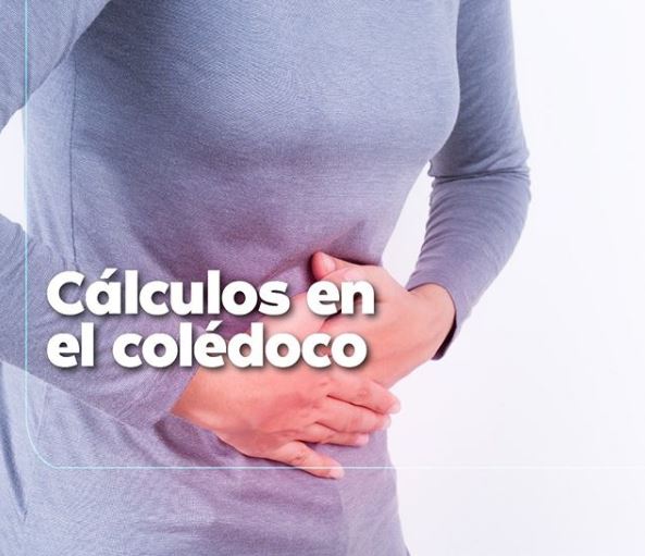calculos coledoco