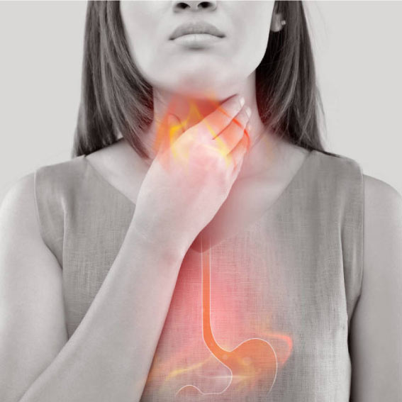 reflujo GASTROEC Doctor Miguel Soria Gastroenterólogo Guayaquil Ecuador