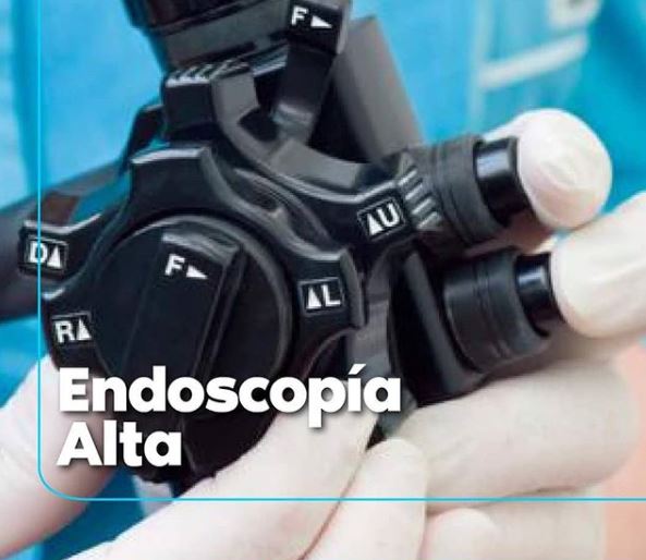 endoscopia alta