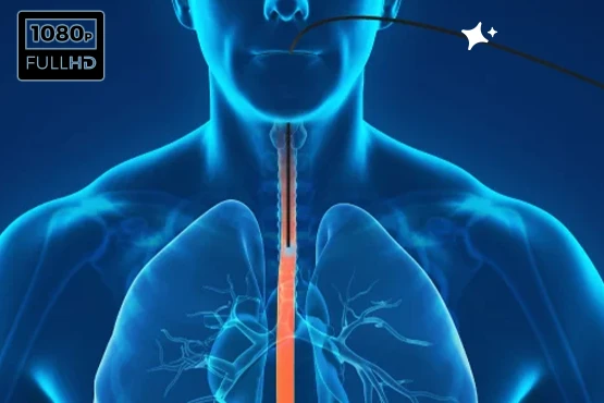 Manometría de alta resolución en Guayaquil